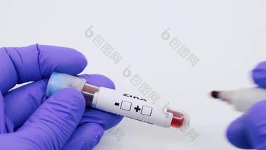 特写镜头微生物学家医疗工人手蓝色的外科手术手套标记血测试结果积极的寨卡病毒病毒寨卡病毒积极的概念