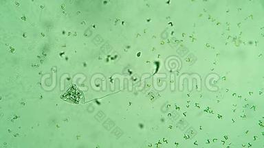 长柄菌尾的纤毛虫以有色水中的细菌为食