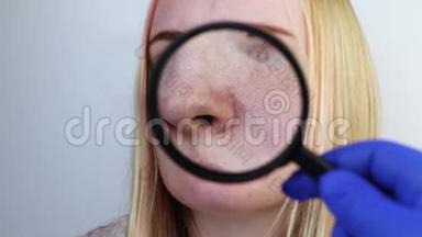 扩大酒渣鼻，毛孔，黑点，鼻子上的<strong>痘痘</strong>特写.. 一名妇女正在接受医生的检查。 皮肤科医生检查