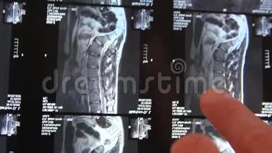 医生`他的手在X光片上显示背面的问题区域