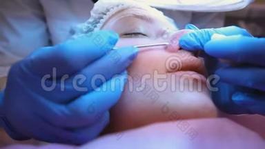 美容师的面部机械清洁。 美容师把粉刺挤在病人鼻子上