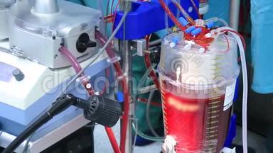 体外循环泵血装置.