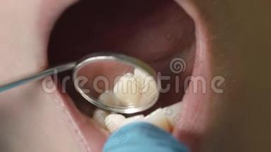 <strong>口腔</strong>和牙齿的检查。 在<strong>口腔</strong>检查过程中，病人年轻女孩张开嘴的特写。