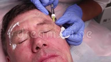 整形外科医生的手在病人`脸上画轮廓。 用于面部轮廓整形的手术。
