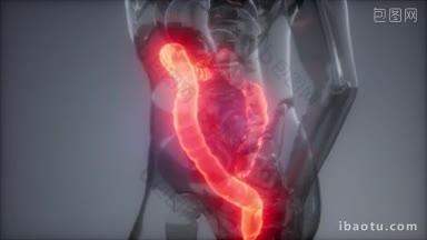 人类结肠放射学检查