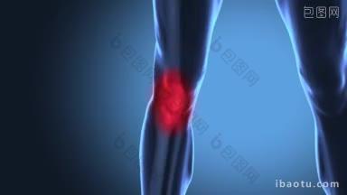 疼痛的人类膝盖概念