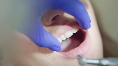 牙齿抛光过程牙医手工作牙科高速度钻