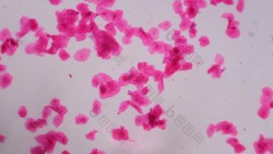 多个鳞状<strong>上皮细胞</strong>显微镜摘要粉红色的点白色背景