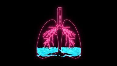 肺水肿全息条件引起的不正常的流体肺泡结果病人困难呼吸缺乏呼吸由于缺乏氧气