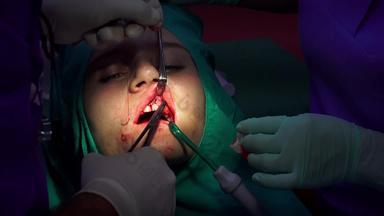 口服手术缝合伤口外科手术线霍尔顿夹特写镜头