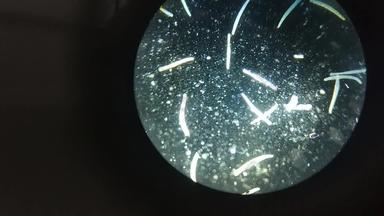 关闭微生物微生物microscop放大宏动画纳米纹理佩特里菜微生物学实验室摘要概念上的生物背景显微镜变焦