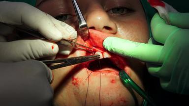 牙医医生持有针持有人缝合伤口操作房间