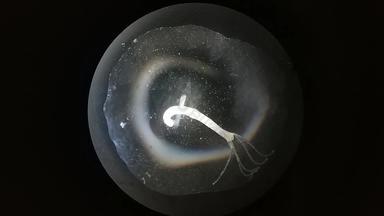 关闭微生物微生物microscop放大宏动画纳米纹理佩特里菜微生物学实验室摘要概念上的生物背景显微镜变焦