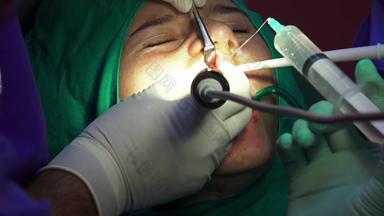 女牙手术医疗操作口服手术眼前切除术黑暗操作房间
