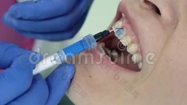 牙医为放置牙科贴面提供基础