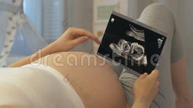 胎儿超声检查