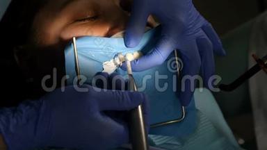 用特殊工具为陶瓷贴面准备病人牙齿。 暗影。 化妆品牙科