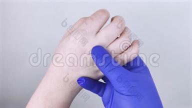手干及皮肤脱皮，真菌病.. 那个女孩向医生皮肤科医生举手。 滋润双手，治疗