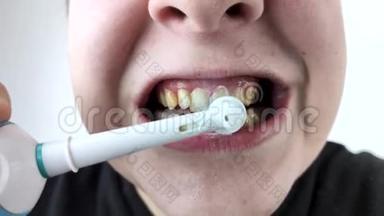 牙龈出血和发炎的情况密切。 男人用电刷刷牙，牙龈出血。