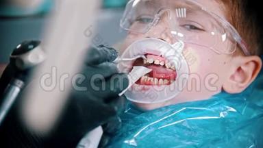 一个<strong>牙齿</strong>受损的小男孩在牙科诊所用一个张开的护嘴<strong>清洁牙齿</strong>