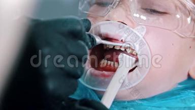 一个戴<strong>防</strong>护<strong>眼镜</strong>的男孩在牙科中进行牙齿清洁治疗-用吸管收集多余的水