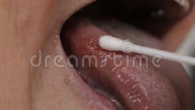 在女人的舌头上涂抹一次疾病。 舌炎和牙龈炎的研究理念，医学
