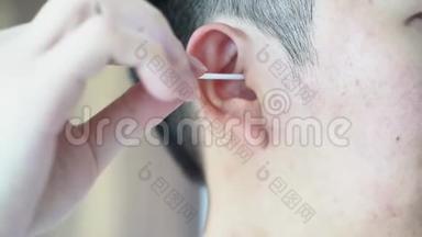人用棉签清洁耳朵.
