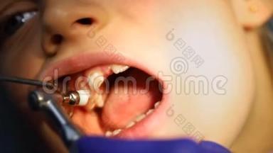牙科医生为口腔科的儿童做专业的牙菌斑清洁和牙齿`抛光