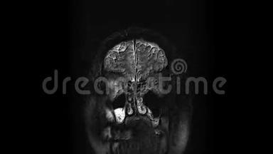 脑和头部的大量MRI扫描以检测肿瘤。 诊断医疗工具