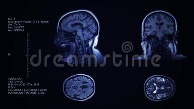 头脑计算机断层扫描结果可视化.. 人头筛查的四个分区幻灯片.. 3D医学放射检查
