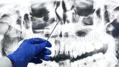 医生在大屏幕上显示x光，检查鼻腔.. 现代医学和技术。