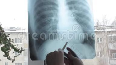 病人<strong>肺部</strong>肺炎€™s图像。