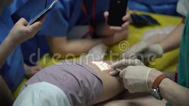 医生外科医生在手术室用特殊设备做腿部手术。 4k视频特写
