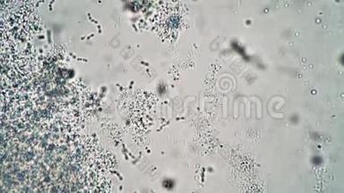 在装有细菌的药物上用照相机拍摄，以便在显微镜下检查