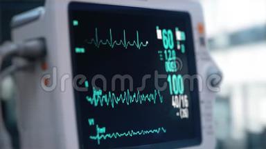 医院剧院的心率监测仪。 麻醉手术医院医用生命体征监测仪