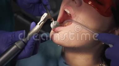 <strong>牙</strong>科医生正在用电<strong>牙</strong>刷`病人的<strong>牙</strong>齿，打开病人的口腔特写。 <strong>牙</strong>齿<strong>护</strong>理