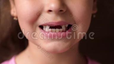 孩子的牙齿。 无牙的微笑。 切根牙。 女孩张开嘴唇，没有露出门牙。 关门