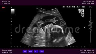 未出生的婴儿在子宫里做迪奥的两指手势。