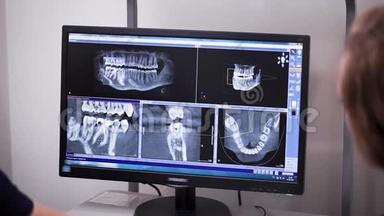 牙医和正畸医生正在监视器上查看病人的牙齿和颌骨的x光片，从后面看