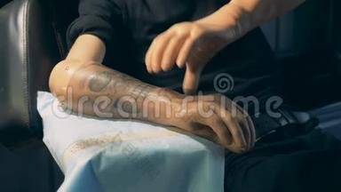 残疾人正在用纹身去除他的合成手臂