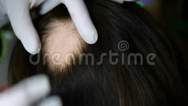 女人脱发。 医生或美容师做检查，做手术，头部的女人皮肤上没有头发。