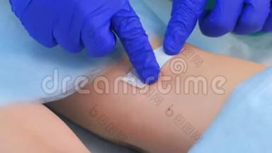 外科医生在取出痣后用石膏封住病人的腿，<strong>双手特写</strong>。