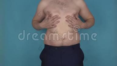 脂肪褶皱，躯干超重，乳房和腹部缓慢摇动。 肥胖，无恩典的<strong>身体</strong>。 丰满的男人还是粗人