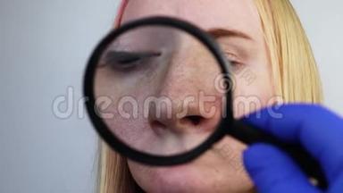 扩大酒渣鼻，毛孔，黑点，鼻子上的痘痘特写.. 一名妇女正在<strong>接受医生</strong>的检查。 皮肤科<strong>医生</strong>检查