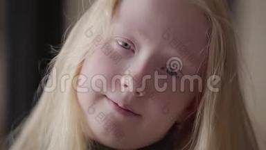 特写一个白化病女孩的肖像，灰色的眼睛看着相机微笑。 不寻常的外表。 <strong>免费儿童</strong>
