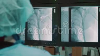 手术室，医生在手术室里做手术看监视器