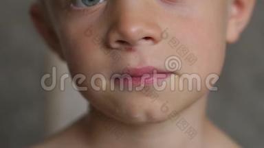 孩子掉下来，挠了挠鼻子下面的皮肤。 男孩脸上的伤口。