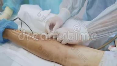 外科医生用无菌手套将针头插入病人腿部进行硬化治疗