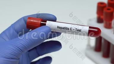 丙型肝炎检测，医生在试管中保存血样，健康检查