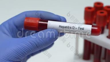 D型<strong>肝炎</strong>检查，医生拿着试管里的血样特写，健康检查